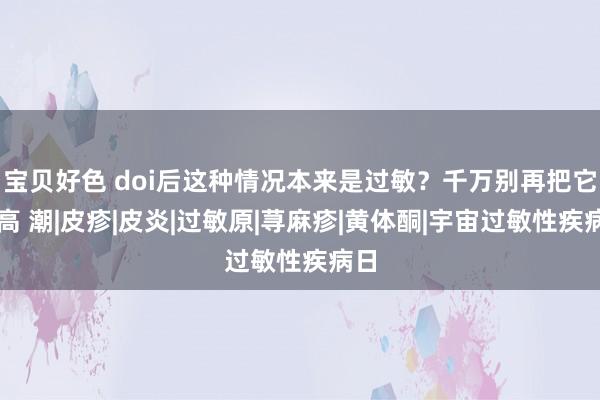 宝贝好色 doi后这种情况本来是过敏？千万别再把它当高 潮|皮疹|皮炎|过敏原|荨麻疹|黄体酮|宇宙过敏性疾病日